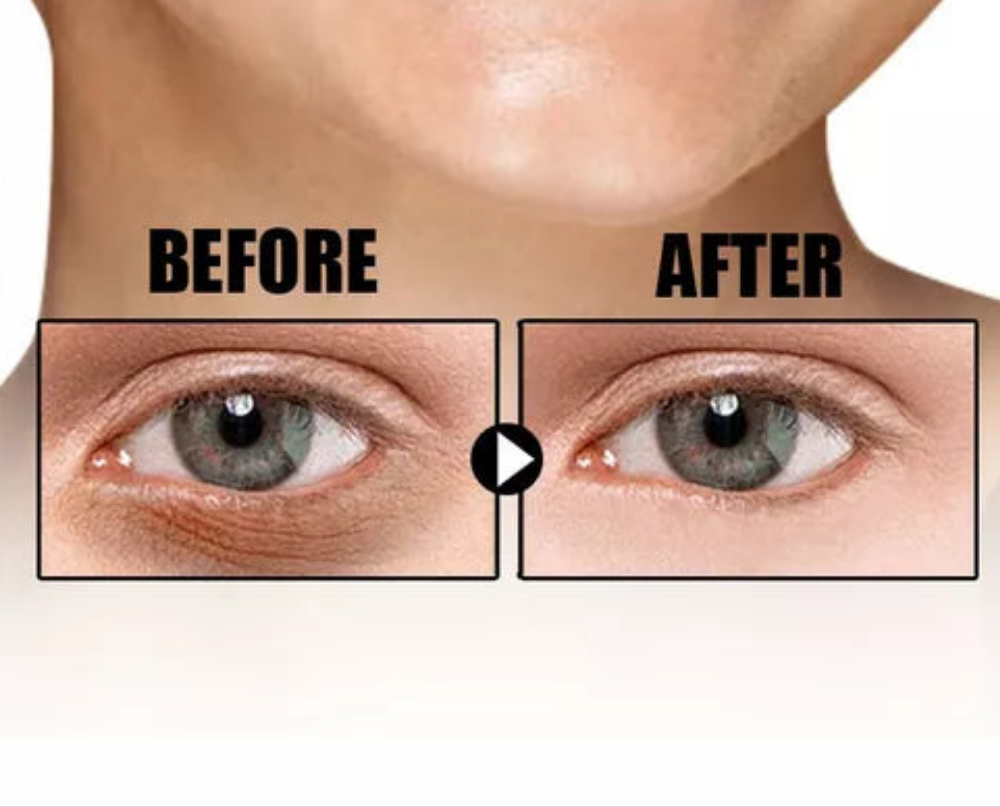 Sérum Anti-Ojeras